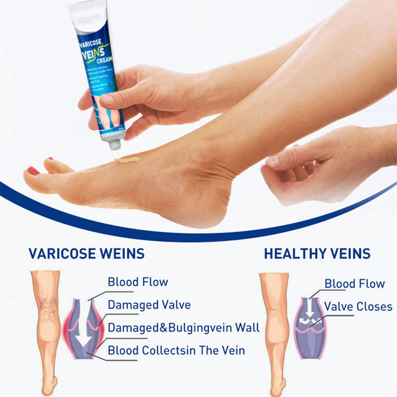 🔥2025 Heißer Verkauf🌿Vein Lishu Creme