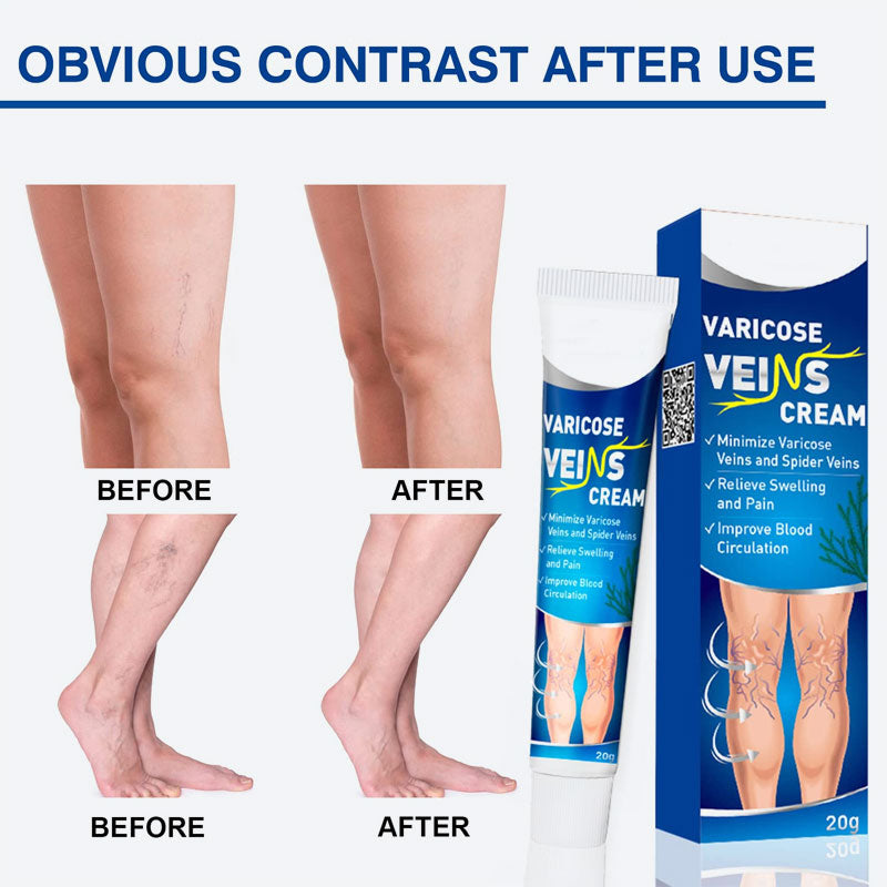 🔥2025 Heißer Verkauf🌿Vein Lishu Creme